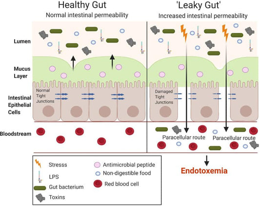 Gut microbiota and Diabetes