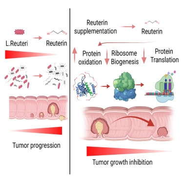 Reuterin and colorectal cancer